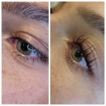 Wimpernlifting